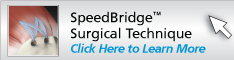 SpeedBridge™