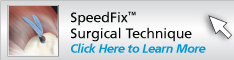 SpeedFix™